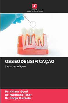 Osseodensificação (Portuguese Edition)