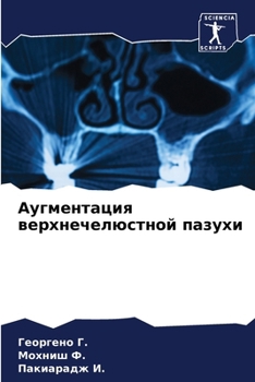 Paperback Аугментация верхнечелю&# [Russian] Book