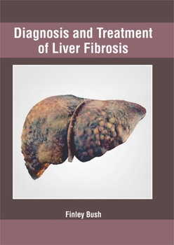 Hardcover Diagnosis and Treatment of Liver Fibrosis Book