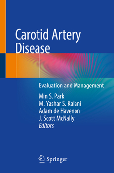 Paperback Carotid Artery Disease: Evaluation and Management Book