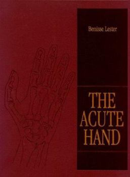 Hardcover The Acute Hand Book
