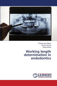 Paperback Working length determination in endodontics Book