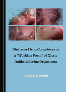 Dinitrosyl Iron Complexes as a Working Form of Nitric Oxide in Living Organisms