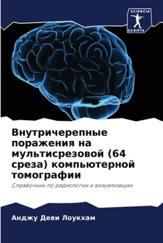 Paperback Внутричерепные поражен&# [Russian] Book