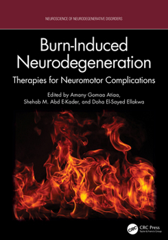 Hardcover Burn-Induced Neurodegeneration: Therapies for Neuromotor Complications Book