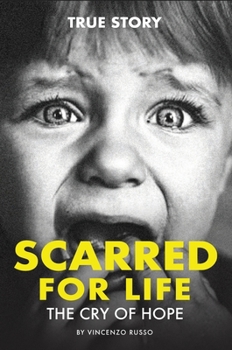 Hardcover Scarred for Life: The Cry Of Hope Book