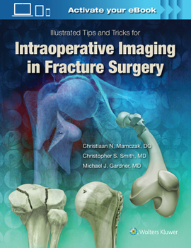 Hardcover Illustrated Tips and Tricks for Intraoperative Imaging in Fracture Surgery Book