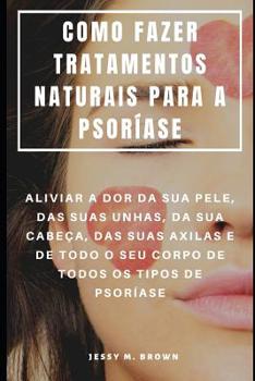 Paperback Como Fazer Tratamentos Naturais Para a Psoríase: Aliviar a Dor Da Sua Pele, Das Suas Unhas, Da Sua Cabeça, Das Suas Axilas E de Todo O Seu Corpo de To [Portuguese] Book