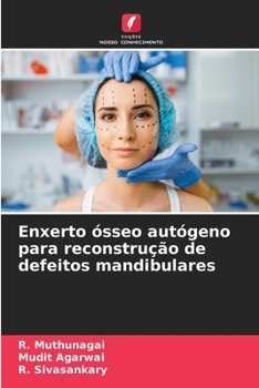 Paperback Enxerto ósseo autógeno para reconstrução de defeitos mandibulares [Portuguese] Book