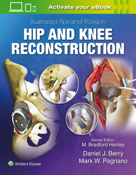 Hardcover Illustrated Tips and Tricks in Hip and Knee Reconstructive and Replacement Surgery Book