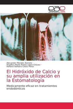 Paperback El Hidróxido de Calcio y su amplia utilización en la Estomatología [Spanish] Book