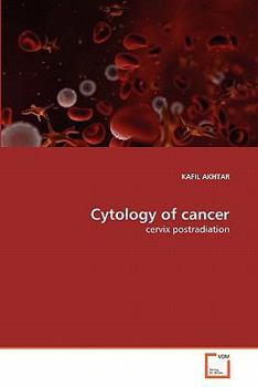 Paperback Cytology of cancer Book