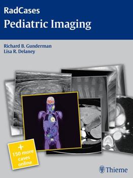 Paperback Radcases Pediatric Imaging [With Access Code] Book