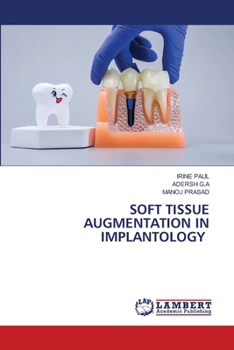 Paperback Soft Tissue Augmentation in Implantology Book