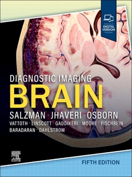 Hardcover Diagnostic Imaging: Brain Book