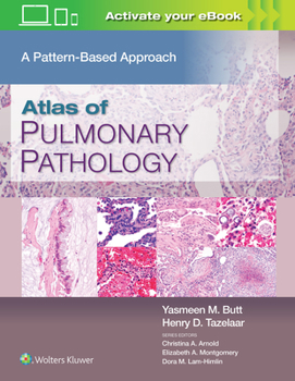 Hardcover Atlas of Pulmonary Pathology: A Pattern Based Approach Book