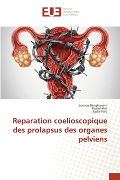 Paperback Reparation coelioscopique des prolapsus des organes pelviens [French] Book