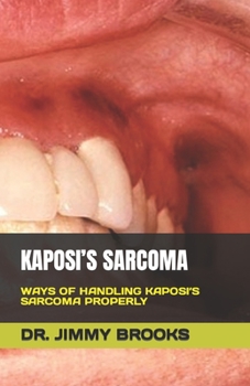 Paperback Kaposi's Sarcoma: Ways of Handling Kaposi's Sarcoma Properly Book