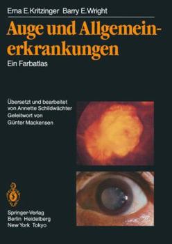 Paperback Auge Und Allgemeinerkrankungen: Ein Farbatlas [German] Book