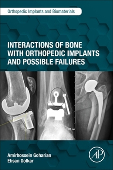 Paperback Interactions of Bone with Orthopedic Implants and Possible Failures Book