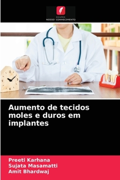 Paperback Aumento de tecidos moles e duros em implantes [Portuguese] Book