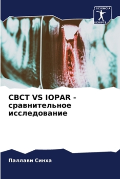 CBCT VS IOPAR - ????????????? ???????????? (Russian Edition)