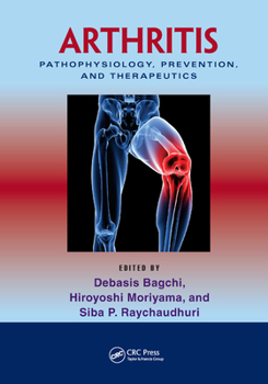 Paperback Arthritis: Pathophysiology, Prevention, and Therapeutics Book