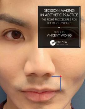 Paperback Decision Making in Aesthetic Practice: The Right Procedures for the Right Patients Book