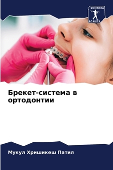 Paperback Брекет-система в ортодон [Russian] Book