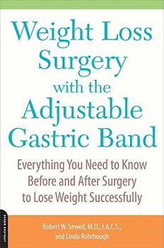 Paperback Weight Loss Surgery with the Adjustable Gastric Band: Everything You Need to Know Before and After Surgery to Lose Weight Successfully Book