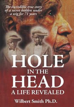 Hardcover Hole in the Head: A Life Revealed Book