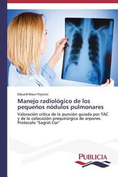 Paperback Manejo radiológico de los pequeños nódulos pulmonares [Spanish] Book