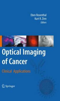 Hardcover Optical Imaging of Cancer: Clinical Applications Book