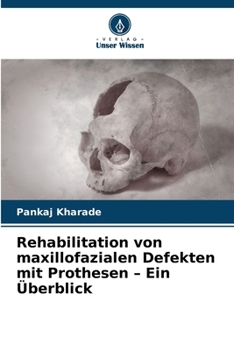 Paperback Rehabilitation von maxillofazialen Defekten mit Prothesen - Ein Überblick [German] Book