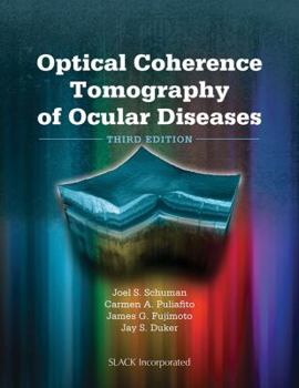 Hardcover Optical Coherence Tomography of Ocular Diseases Book