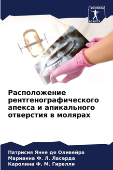 Paperback Расположение рентгеног&# [Russian] Book