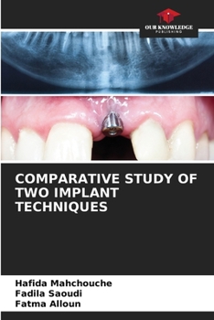 Paperback Comparative Study of Two Implant Techniques Book