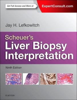 Hardcover Scheuer's Liver Biopsy Interpretation Book