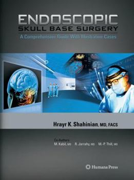 Paperback Endoscopic Skull Base Surgery: A Comprehensive Guide with Illustrative Cases Book