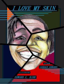 Paperback I Love My Skin Book