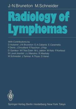 Paperback Radiology of Lymphomas Book