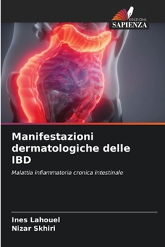 Manifestazioni dermatologiche delle IBD (Italian Edition)