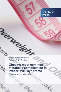 Paperback Obesity; most common metabolic complication in Prader-Willi syndrome Book