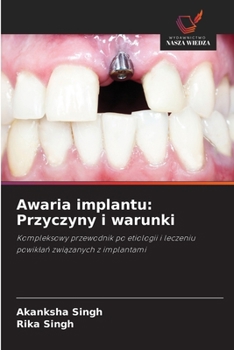 Paperback Awaria implantu: Przyczyny i warunki [Polish] Book