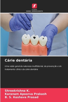 Cárie dentária (Portuguese Edition)