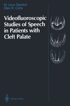 Hardcover Videofluoroscopic Studies of Speech in Patients with Cleft Palate Book