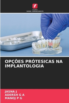 Opções Prótesicas Na Implantologia (Portuguese Edition)