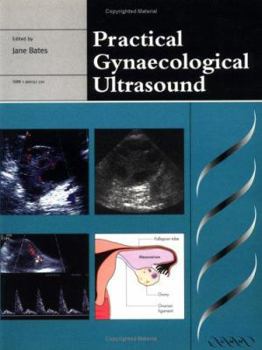 Paperback Practical Gynaecological Ultrasound (Greenwich Medical Media) Book