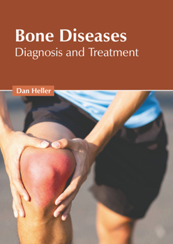 Hardcover Bone Diseases: Diagnosis and Treatment Book