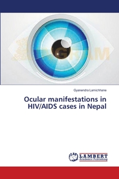 Paperback Ocular manifestations in HIV/AIDS cases in Nepal Book